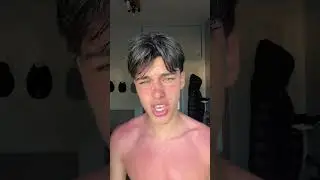first time I've ever gotten sunburnt and turned tomato red 🍅