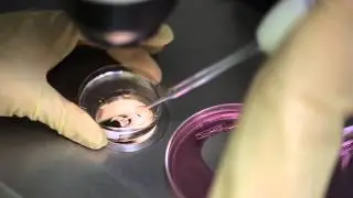 Embriyo transferi nedir, nasıl yapılır?
