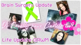 Chit Chat, GRWM, Cancer, lymphoma, brain aneurysm update, #cancer #lymphoma #aneurysm #chitchat