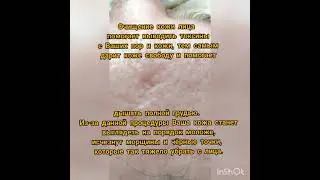 Чистка кожи лица.
