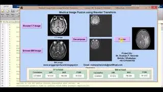 Image Fusion using Wavelet Transform Full Matlab Project Source Code
