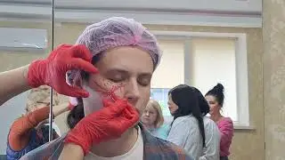 ГК средняя треть. Разметка.