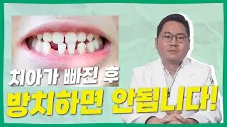 치아 발치부터 임플란트까지! 치아 발치 후 꼭 치료받으세요