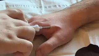 Biohacking at Defcon 2023 - Defcon 31 NFC/RFID Injection