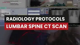 Lumbar Spine CT: Protocol Guide for Computed Tomography Techs