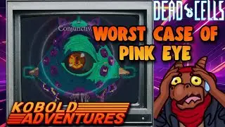 Eye Sore! | Dead Cells do over