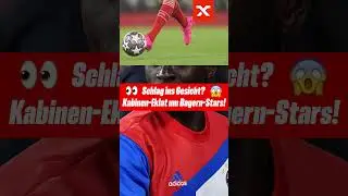 Schlag ins Gesicht? 😱 Bayern-Star rastet wohl aus! 😳 #shorts