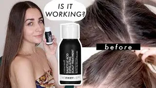 I USED The Inkey List Salicylic Acid Exfoliating Scalp Treatment FOR 2 MONTHS TEST | HONEST REVIEW