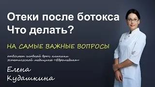 Отеки после ботокса. Что делать?