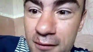 ВСЕМ ДОБРОГО ДНЯ!) / ЛЕЧЕНИЕ ДО БОЛЕЗНИ / ХИРОМАНТИЯ /