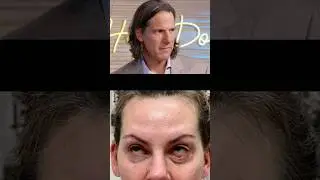 Plastic Surgeons React to Eyelid Surgery Gone Wrong!