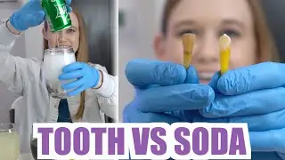 TOOTH Experiment vs. 4 Popular DRINKS 👩🏼‍⚕️
