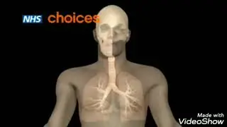 Bronxial astma haqida interaktiv videorolik
