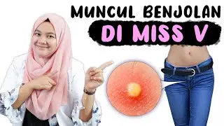 VARIOUS LUMPS IN THE VAGINA - DOCTOR WSP