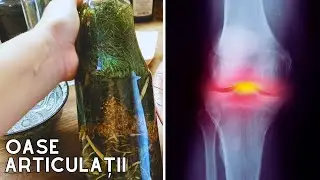 Cel mai bun Remediu pentru Oase și Articulații