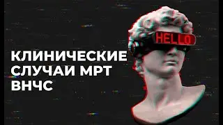 КЛИНИЧЕСКИЕ СЛУЧАИ МРТ ВНЧС
