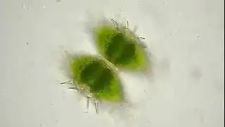 Staurastrum setigerum