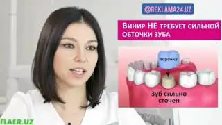 Что такое виниры?  Для чего они используются?