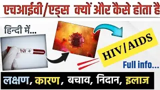 एचआईवी/एड्स के लक्षण, कारण, इलाज || hiv aids ke lakshan || hiv aids ka ilaj kya hai || hiv aids