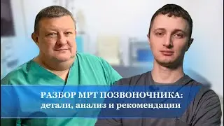 Разбор МРТ позвоночника: детали, анализ и рекомендации.