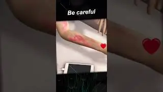 #Be
