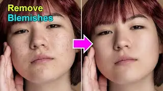 One Click to Remove Blemishes