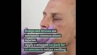 First Aid for Treating Minor Injuries at Home