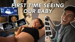 OUR FIRST TRIMESTER ULTRASOUNDS!