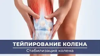 Тейпирование колена. Тейпирование ноги. Тейпирование при болях. Ортотейпинг.