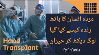 Hand transplant surgery with latest technology.  #Transplant #Organtransplant #DrMessy