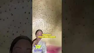 Как очистить забитые поры? 