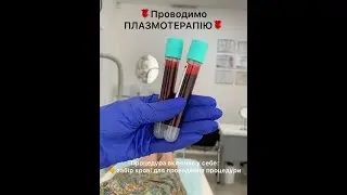 Плазмотерапія. Медичний центр Оксфорд Медікал Хмельницький