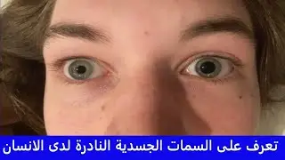 هل لديك واحدة من هذه السمات الجسدية النادرة