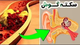 حتما حتما به این علائم گوش , جرم گوش , و وز وز گوش توجه کنید