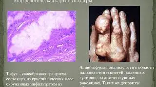 Дифференциальная диагностика заболеваний суставов