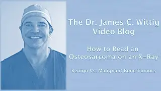 How to Read an Osteosarcoma on an X-Ray: Benign vs. Malignant Bone Tumors