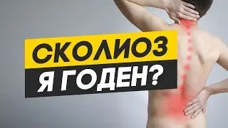 Берут ли в армию со сколиозом? С чем не берут в армию