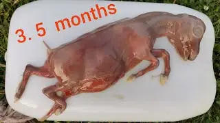 выкидыш