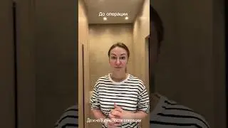 Блефаропластика и липосакция подбородка. До и на 8 день после.