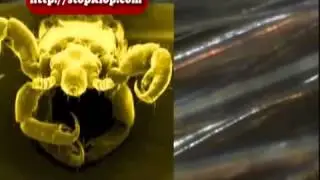 Насекомые кровососы. Опасность рядом.