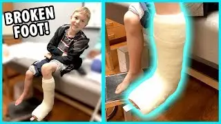 Getting a Cast! Jacob Broke His Foot - Part 2