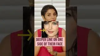 Stop 🛑 the Asymmetric Smile Lines with face exercises
