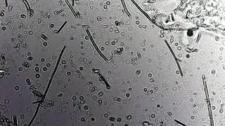Ciliate (at-home scope)