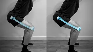 This Lifestyle Routine Fixes Bone Density