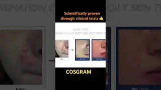 Cosgram Fiber Pointer & Dropper #skincare #antiaging #beauty #skin #dermatologist #glowingskin