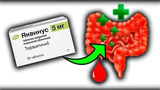 This NEW DRUG Will Change Ulcerative Colitis Treatment FOREVER! Tofacitinib JAKVINUS