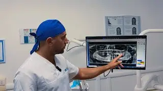 Nuovi denti sopra e sotto in 4 ore! Dott. Vittorio Magnano - Dental One
