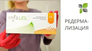 РЕДЕРМАЛИЗАЦИЯ HYALUAL