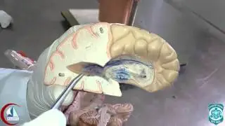 Lateral ventricle (Model) | Practical anatomy 2nd year