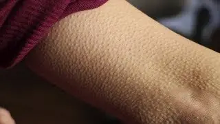 If You Get Goosebumps When Listening to Music, the Symptom Could Be a Sign That You're Different